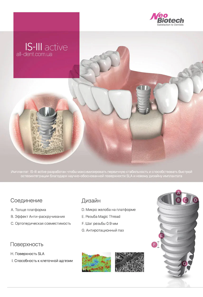 Имплант необиотек. Имплантат NEOBIOTECH. NEOBIOTECH импланты система. Имплант Нео Биотеч. Внутрикостная дентальная имплантация системы NEOBIOTECH.