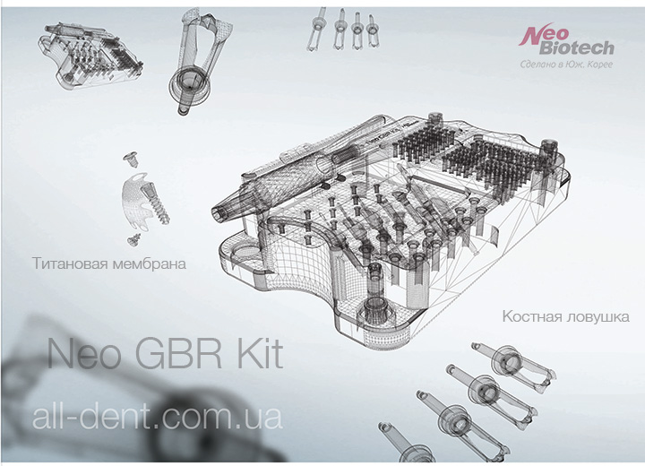 NeoBiotech Набор GBR Kit alldent
