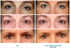 Colorescience Крем для области вокруг глаз SPF 35 Total Eye™ 3-в-1