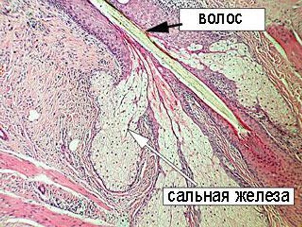 Сальные железа кожи головы