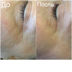 Браш для чувствительной кожи с вибрацией Zeitgard