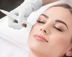 Аппарат для RF лифтинга 11