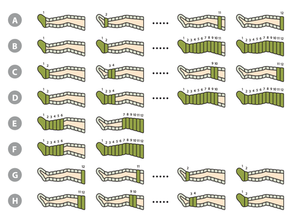 Аппарат для прессотерапии Lympha-Tron комплектация комбинезон