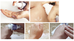 Тонізуючий лосьйон all-in-one для проблемної та жирної шкіри Acleon Seboderm Clarifying Toning Lotion