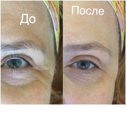 Браш для чувствительной кожи с вибрацией Zeitgard