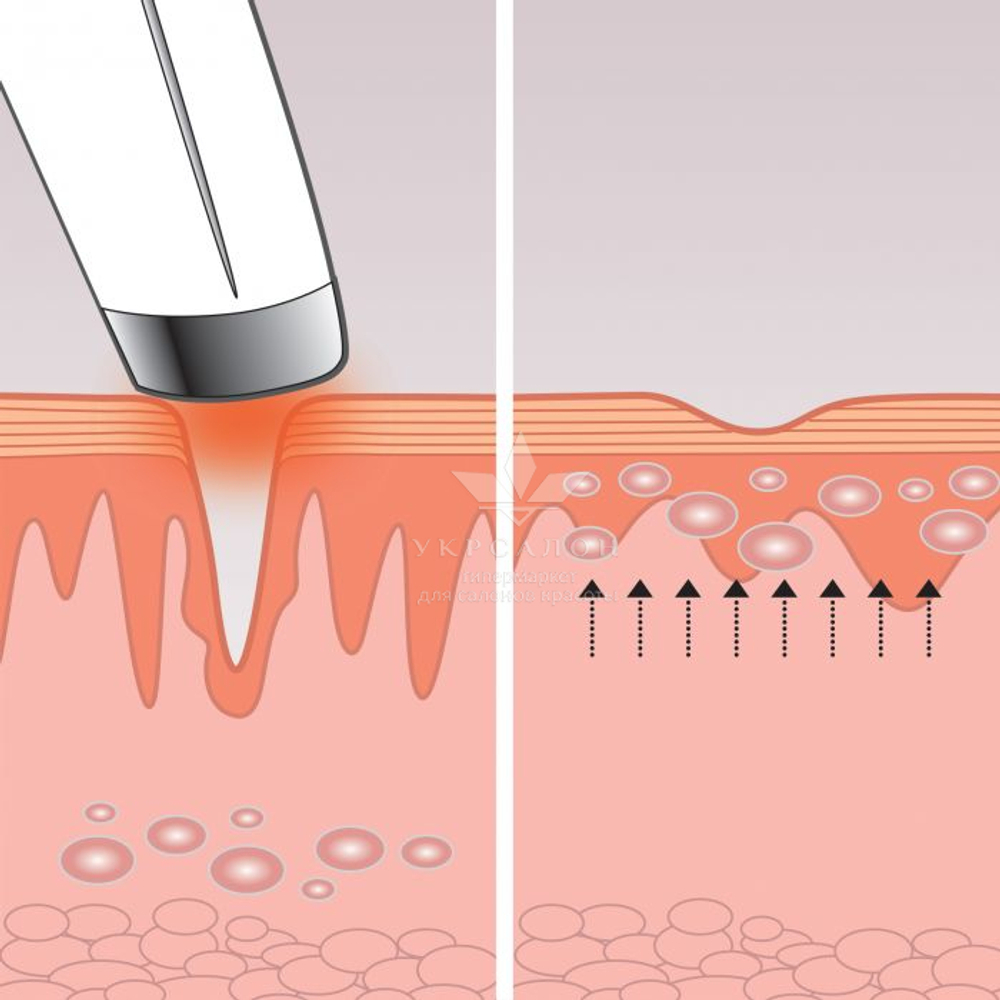 Масажер для очей eye revive luxe