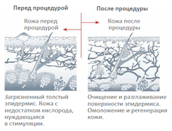 Косметологічний комбайн ULTRA CAVI SONIC
