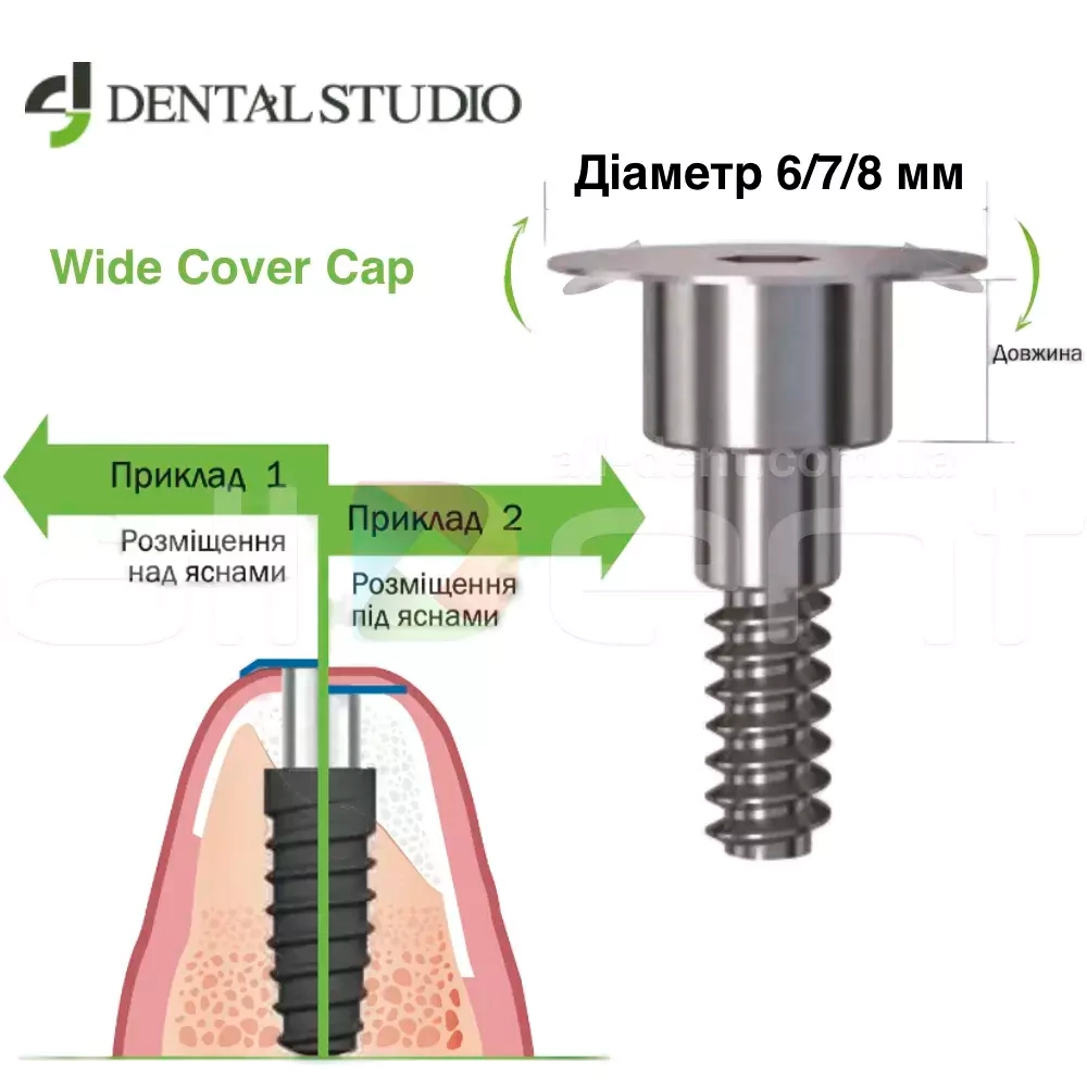 Wide Cover Cap Dental Studio