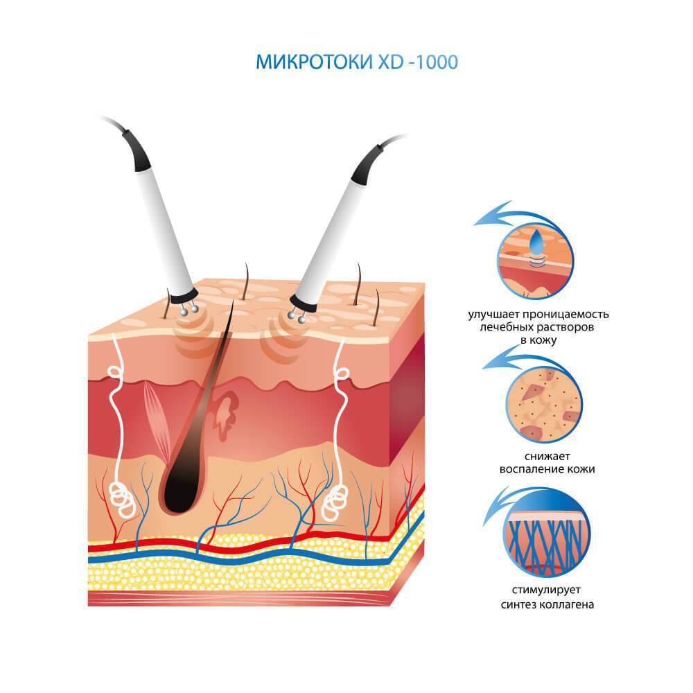 Микротоковый аппарат Premium XD-1000 Alvi-Prague