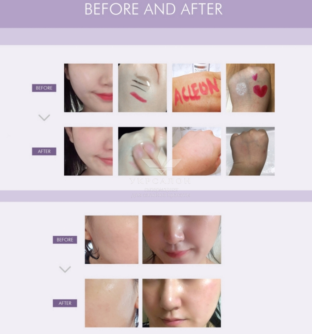 Гіпоалергенний гель для очищення шкіри Acleon Seboderm Purifying Cleanser