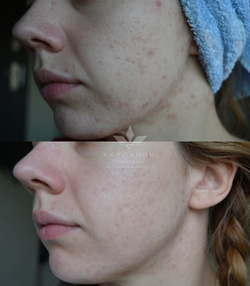 Сироватка для вирівнювання рель`єфу шкіри Galactomyces Ferment Filtrate 100