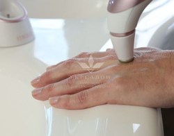 Аппарат для микродермабразии Radiance Rose