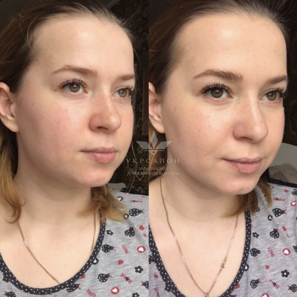 CC-крем Dr.Hedison потрійної дії з SPF38