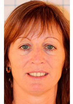 Газожидкостная система M206