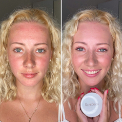 Кушон многофункциональный Miracle Cushion SPF50 PA+++ со сменным блоком Dr.Hedison