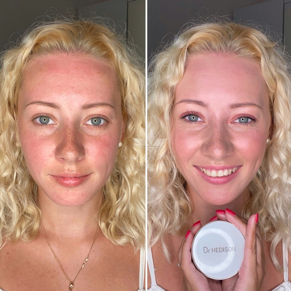 Кушон многофункциональный Miracle Cushion SPF50 PA+++ со сменным блоком Dr.Hedison