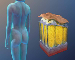 Косметологический аппарат LipoDerm