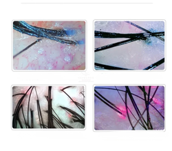 Трихоскоп Premium Plus 50/200x