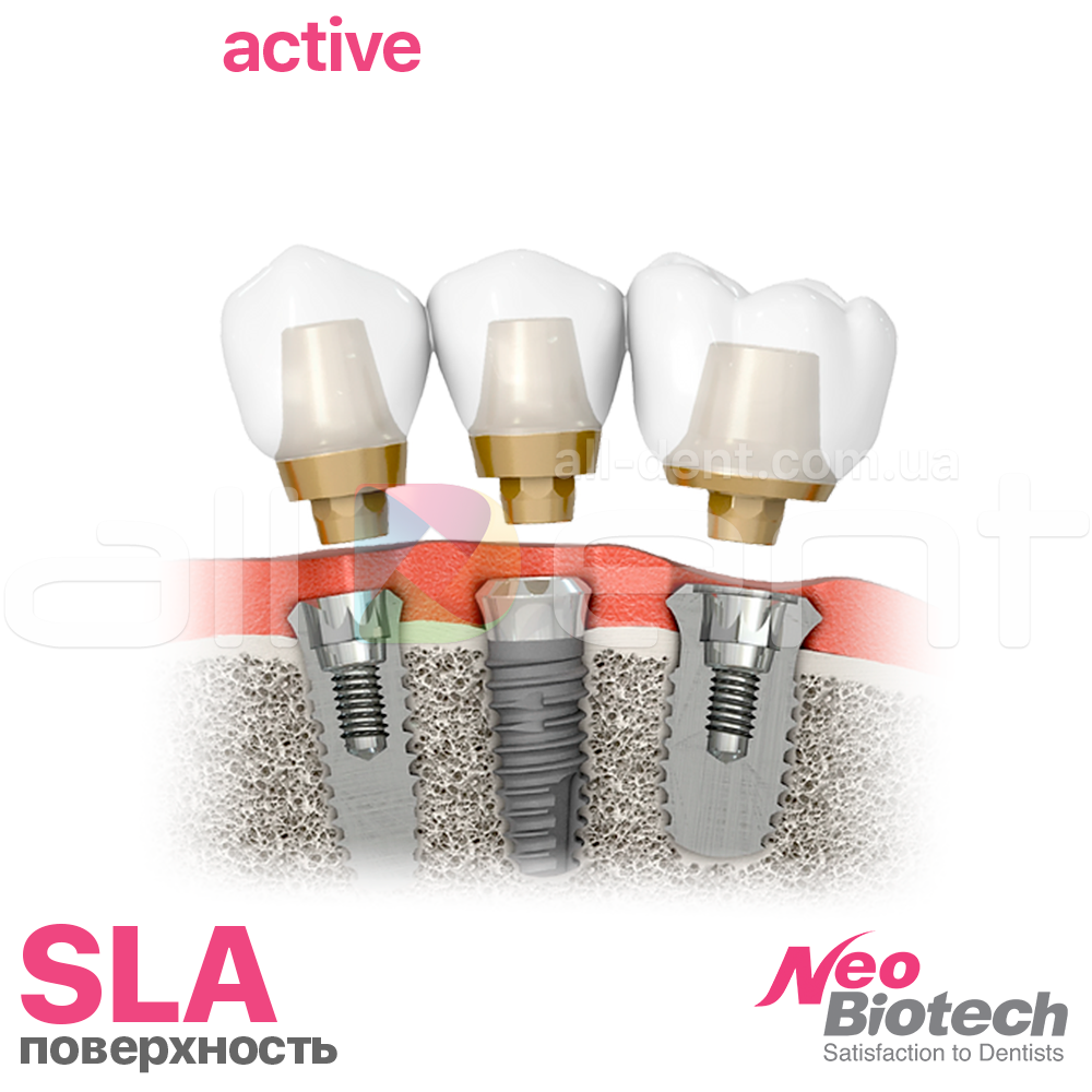 Корейський імплант NeoBiotech IT-IIІ Active Необіотех