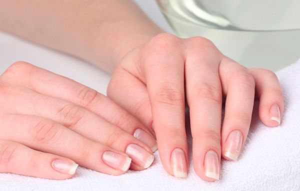 Причини розшарування нігтів і способи боротьби з проблемою