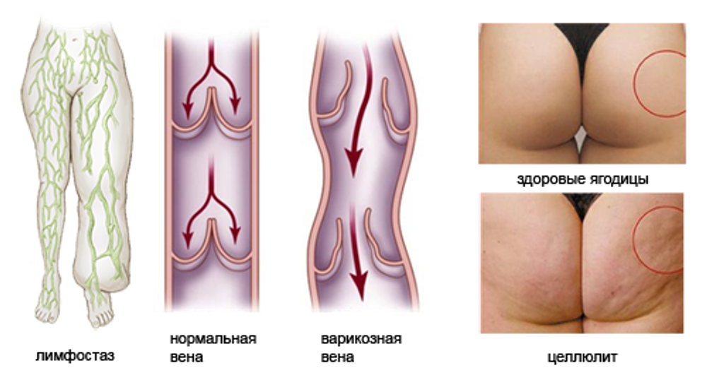 Лимфодренажный аппарат LX-7 Домашний