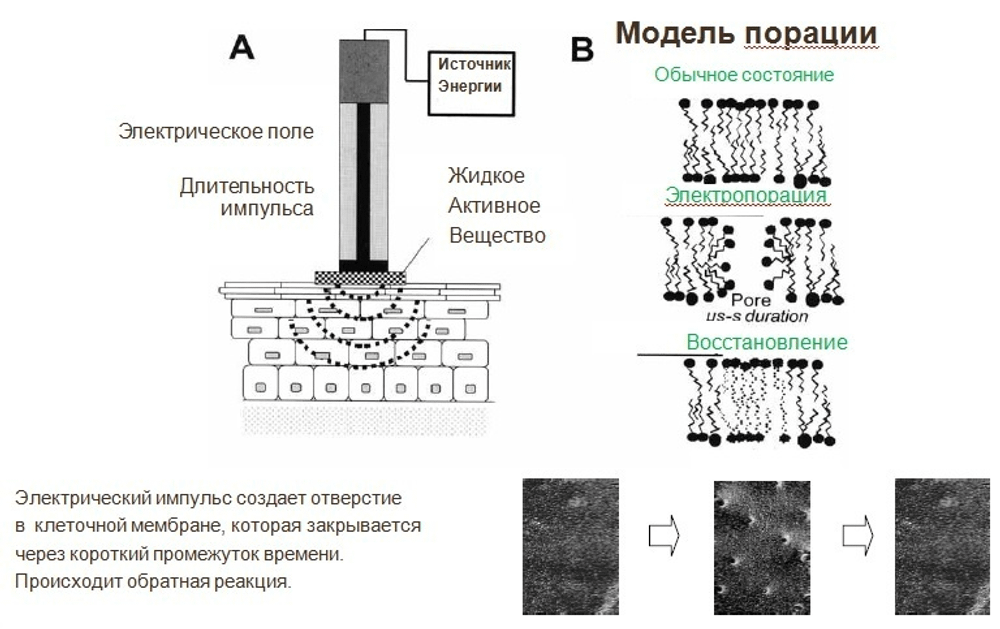 Аппарат для RF–лифтинга и электропорации «CareBuiw»