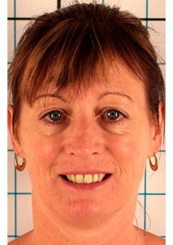 Газожидкостная система M206