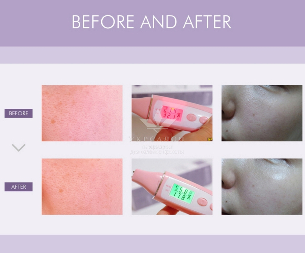 Тонізуючий лосьйон all-in-one для проблемної та жирної шкіри Acleon Seboderm Clarifying Toning Lotion