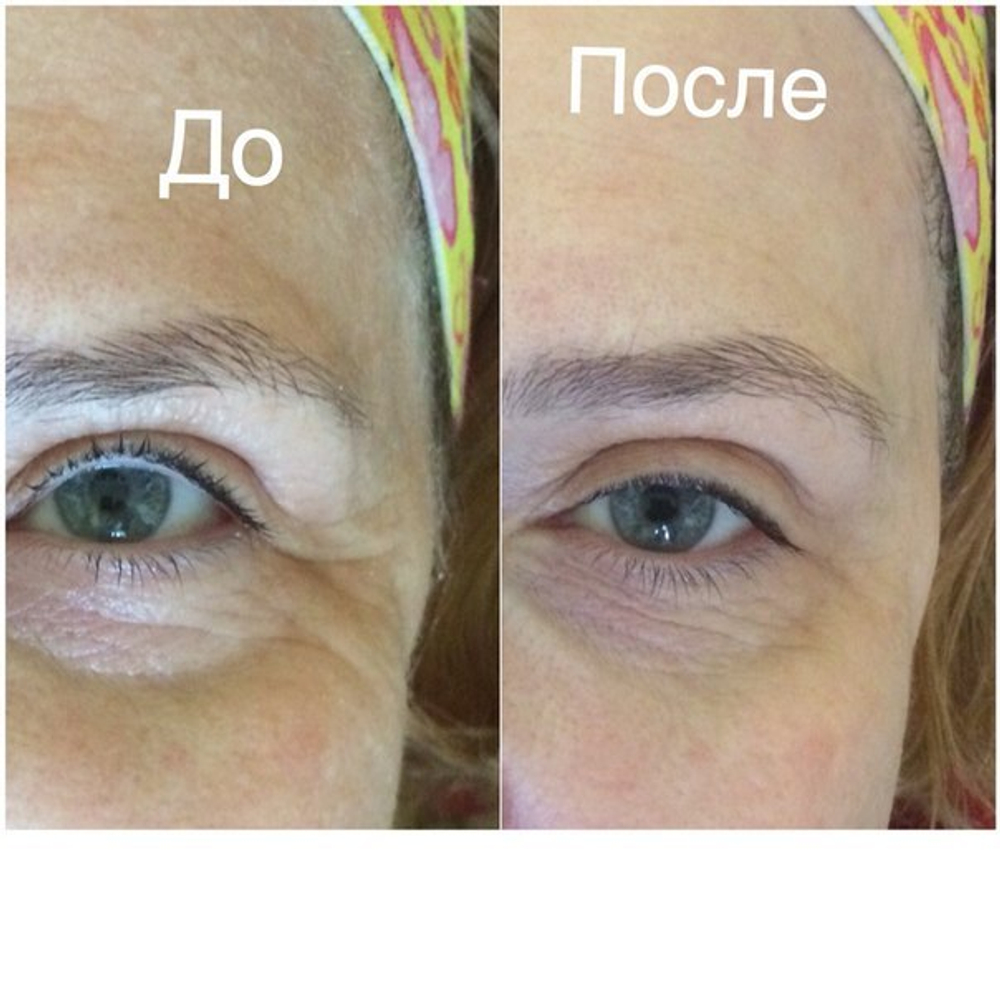 Браш для чувствительной кожи с вибрацией Zeitgard