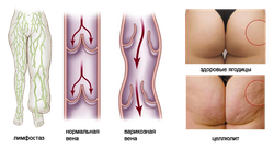 Лимфодренажный аппарат LX-7 Домашний