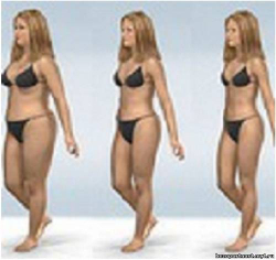 Косметологический аппарат LipoDerm