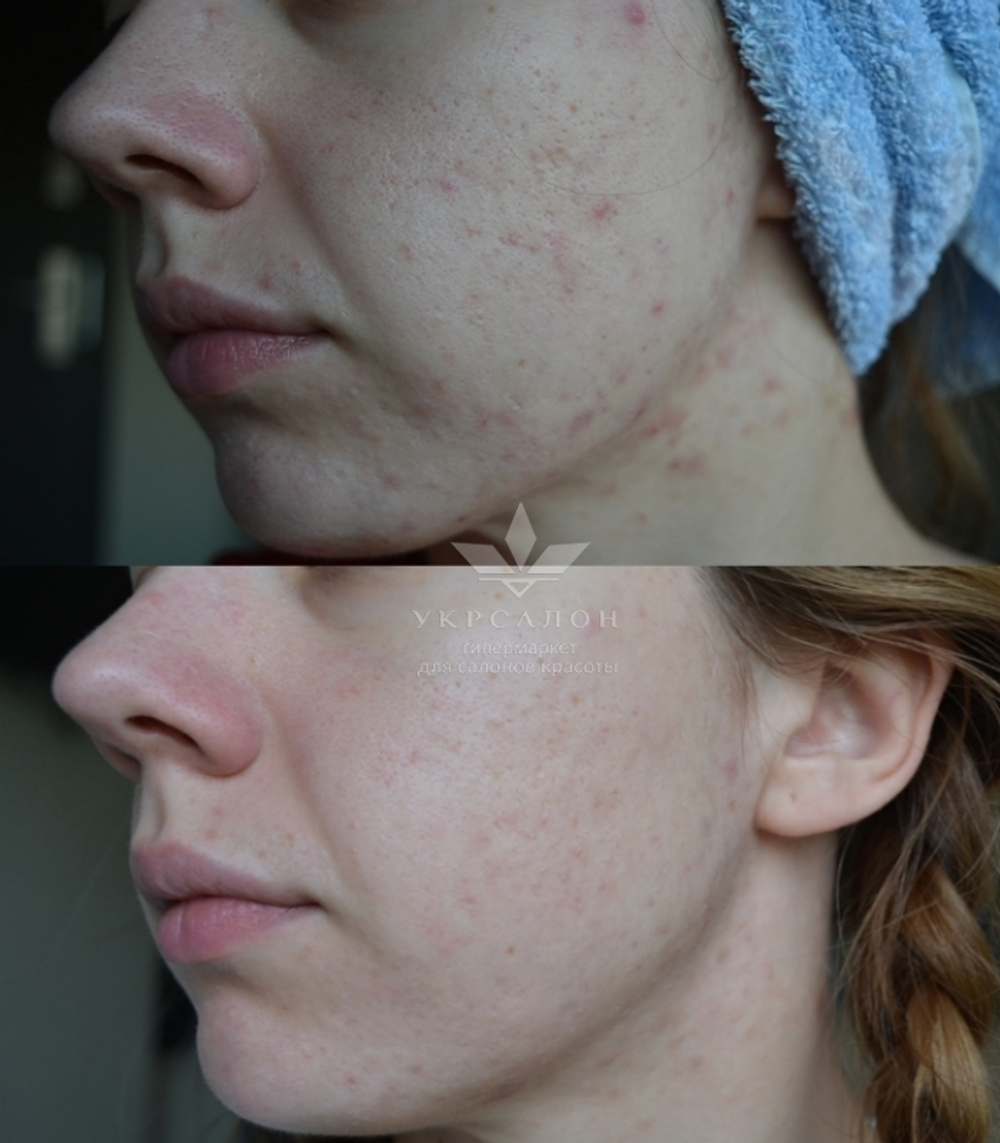 Сироватка для вирівнювання рель`єфу шкіри Galactomyces Ferment Filtrate 100