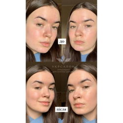 CC-крем Dr.Hedison потрійної дії з SPF38