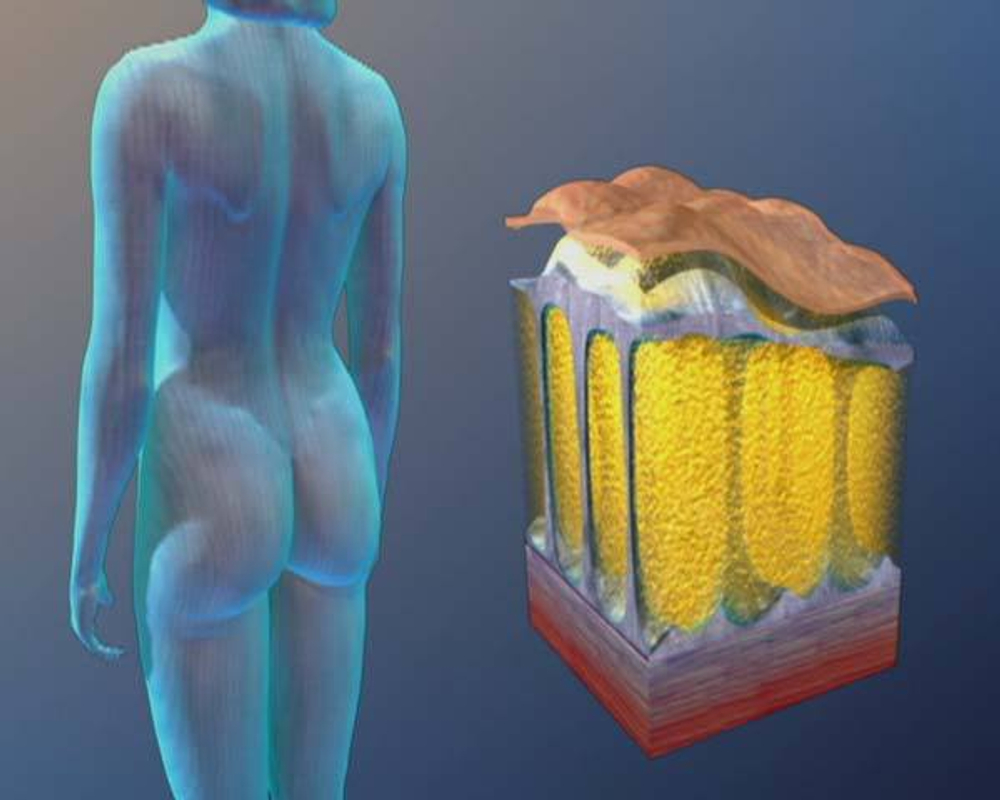 Косметологический аппарат LipoDerm