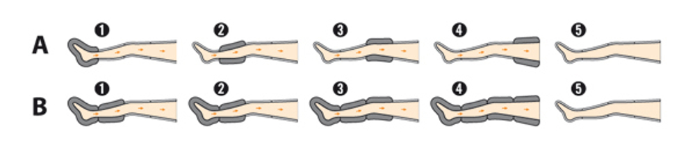 Лимфодренажный аппарат LX-7 Домашний