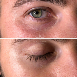 Гідрогелеві патчі Dr.Hedison з пептидами для зони навколо очей Returning Eye Patch