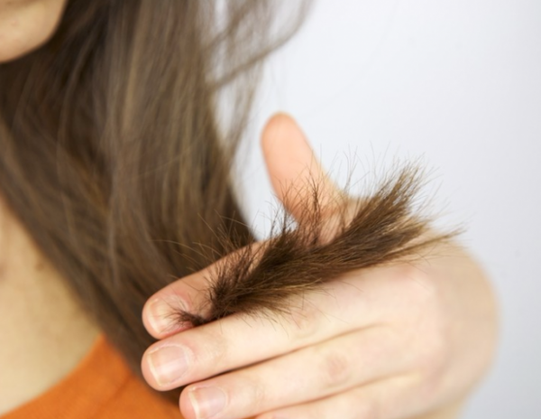 Волосся, що січеться: причини, способи лікування і профілактики