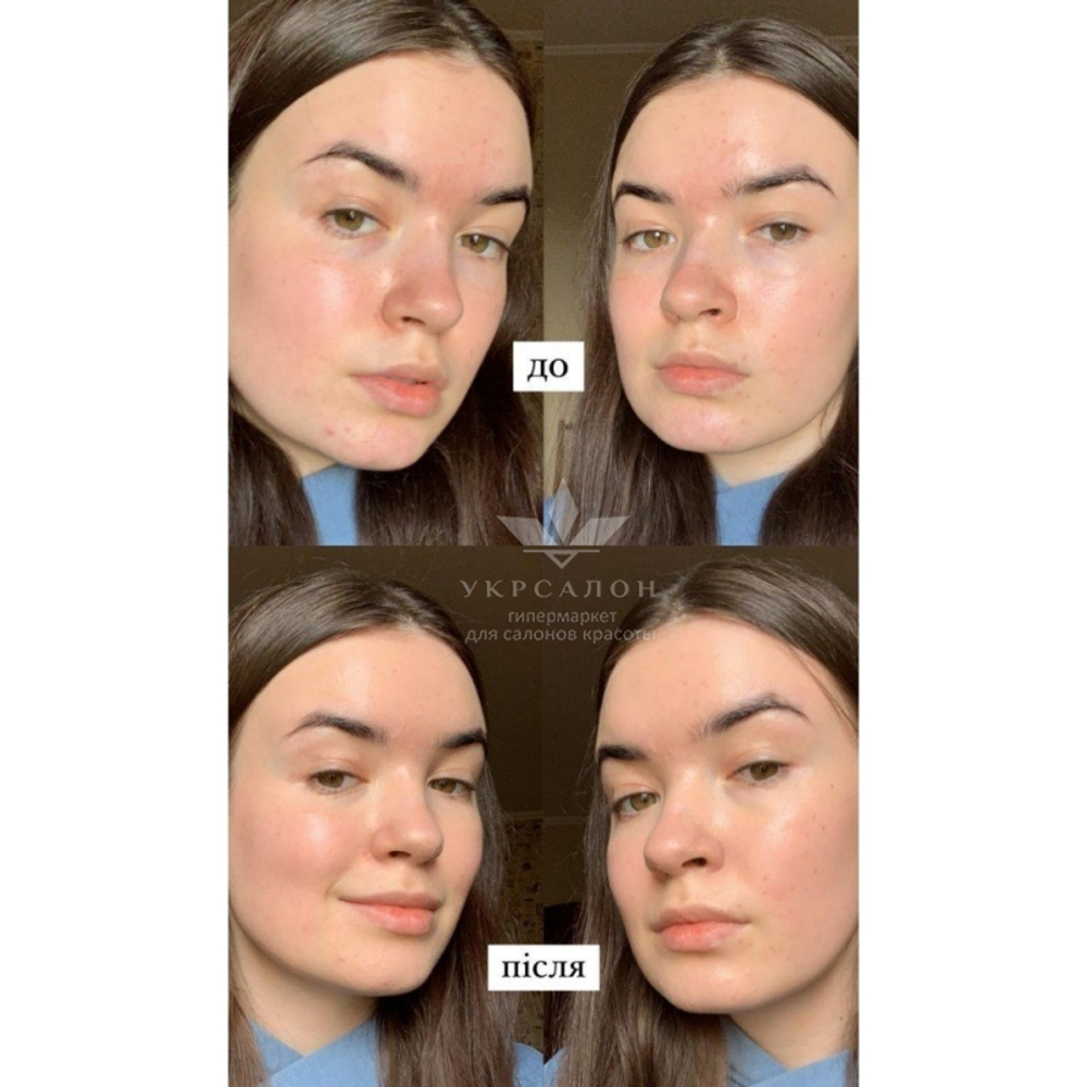 CC-крем Dr.Hedison потрійної дії з SPF38