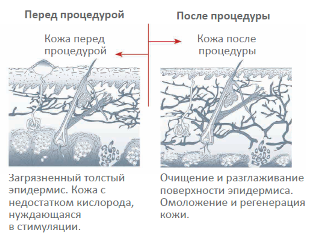 Косметологічний комбайн ULTRA CAVI SONIC