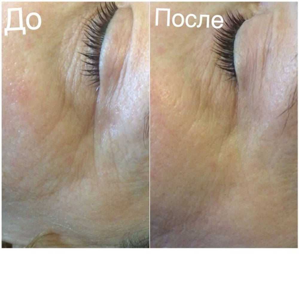 Браш для чувствительной кожи с вибрацией Zeitgard