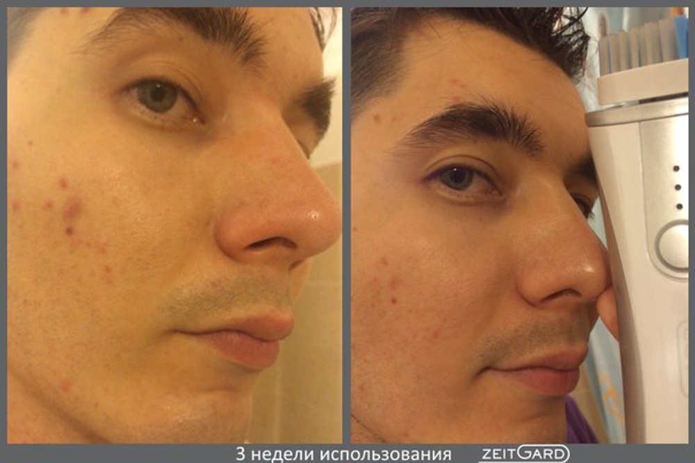 Браш для нормальной  кожи с вибрацией Zeitgard