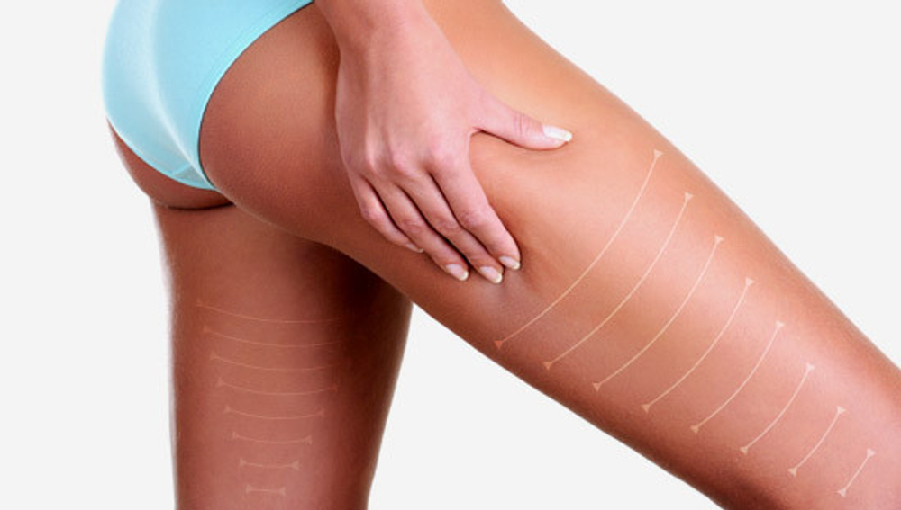 Аппарат для прессотерапии Lympha-Tron комплектация комбинезон