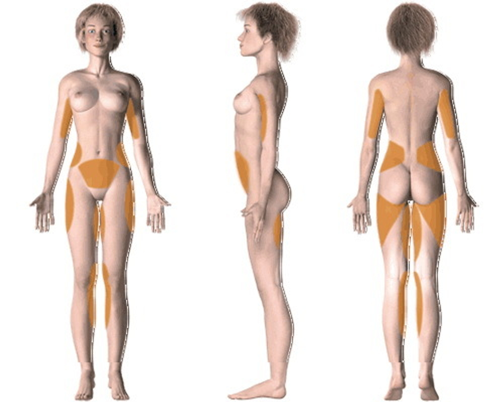 Косметологический аппарат LipoDerm