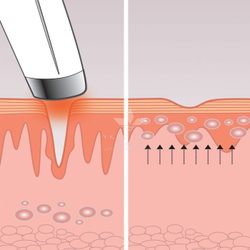 Масажер для очей eye revive luxe