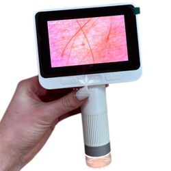 Трихоскоп с дисплеем