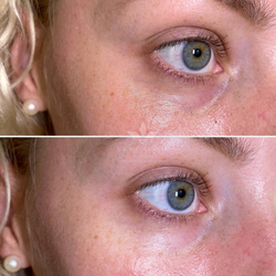 Гідрогелеві патчі dr.hedison vital energy з волюфіліном і пептидами